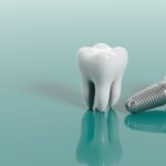 Dental Implants Milton Keynes: Why More People Are Choosing This Treatment