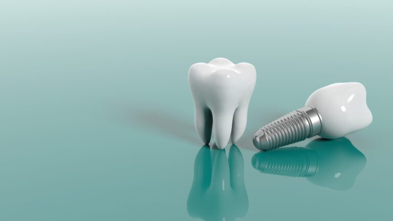 Dental Implants Milton Keynes: Why More People Are Choosing This Treatment