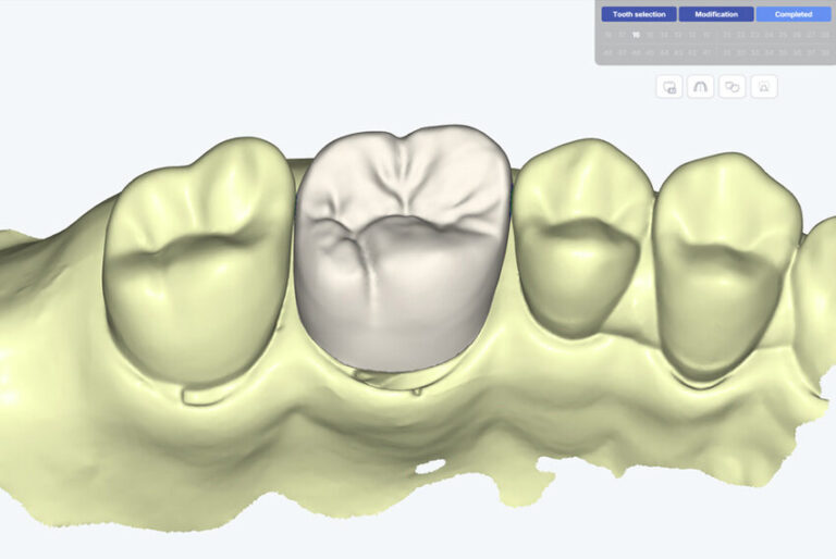 Why More Dental Clinics Are Standardising Restorations via a Dental CAD Hub